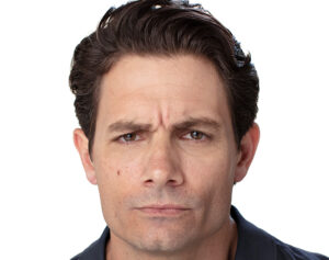 Frown Lines Before