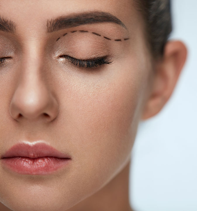Eyelid Surgery