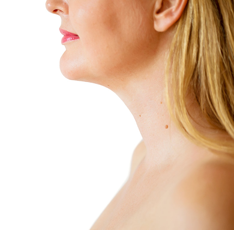 Face and Neck Liposuction