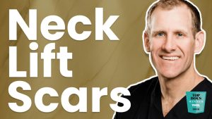 Neck Lift Scars | Elite Facial Plastic Surgery